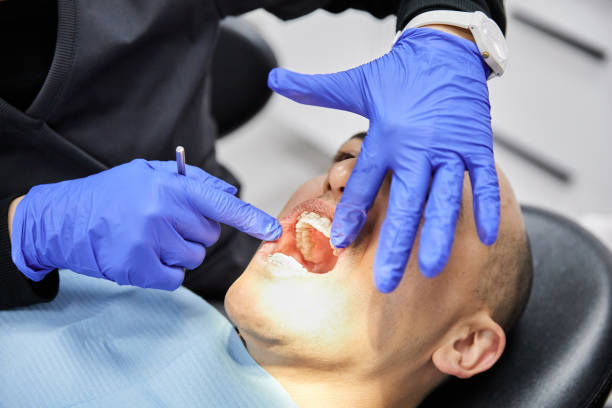 Best Emergency Gum Pain Relief  in Alta Sierra, CA